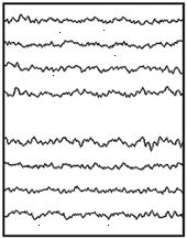 Normal EEG