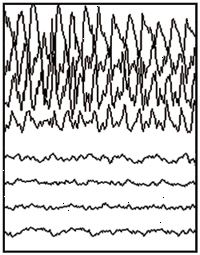 Ejecución parcial EEG