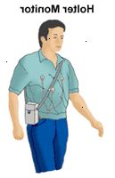 Ilustración de un hombre que lleva un monitor Holter