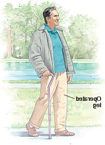 Sostenga su bastón en el lado de su pierna no operada. Mueva el bastón como paso con la pierna operada.