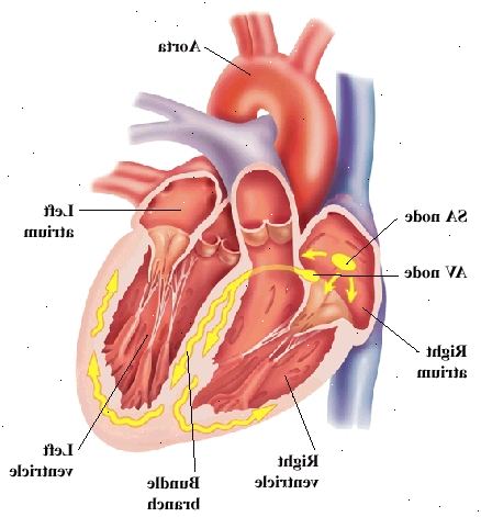 Vista frontal del corazón que muestra en la parte superior aurículas y los ventrículos en la parte inferior. Aorta es gran arteria que sale del corazón en la parte superior. Nodo SA y el nodo AV están en la aurícula derecha. Nervios de rama se encuentran en la pared entre los ventrículos y la curva de las paredes ventriculares. Las señales de AV nodo viajes al nodo AV y en ramas del haz.