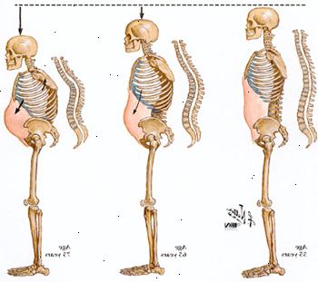 ¿Cómo comprime la columna vertebral con la edad