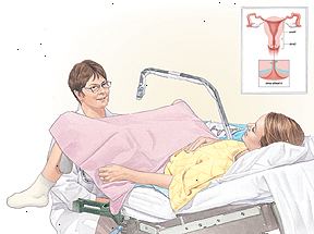 Mujer acostada sobre una camilla con los pies en los estribos. Proveedor de atención médica está sentado entre las piernas de la mujer.