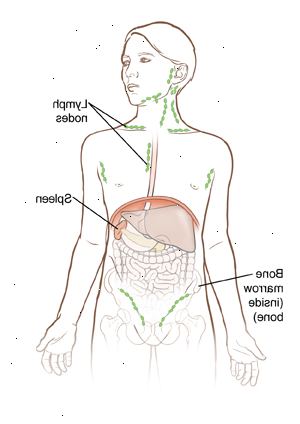 Los ganglios linfáticos, médula ósea y el bazo son todas las partes del sistema linfático. Este sistema trabaja para ayudar al cuerpo a combatir infecciones.