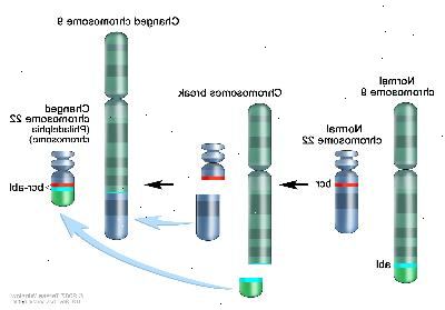 Cromosoma Filadelfia, tres paneles del dibujo muestran una sección del cromosoma 9 y una sección del cromosoma 22 que se rompen e intercambian lugares, creando un cromosoma 22 alterado llamado cromosoma Filadelfia. En el panel izquierdo, el dibujo muestra el cromosoma 9 normal con el gen abl y el cromosoma 22 normal con el gen bcr. En el panel central, el dibujo muestra el cromosoma 9 que se separa en el gen abl y el cromosoma 22 que se separa por debajo del gen bcr. En el panel de la derecha, el dibujo muestra el cromosoma 9 con la sección del cromosoma 22 y el cromosoma 22 con la sección del cromosoma 9 que contiene parte del gen abl unido. El cromosoma 22 alterado con el gen abl-bcr se llama cromosoma Filadelfia.