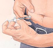 Inyección de insulina del paciente en el abdomen