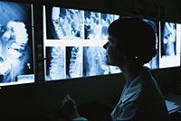 Fotografía de un médico visualización enema de bario de películas de rayos X