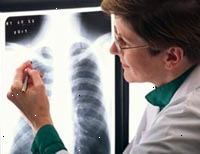 Fotografía de una radióloga leyendo una placa de rayos x
