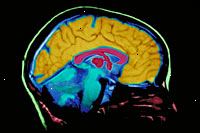 Una imagen de una película de imagen de resonancia magnética del cerebro
