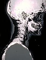 Una imagen de una radiografía de la cabeza