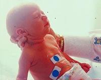 Fotografía de un bebé en la unidad de cuidados intensivos neonatales