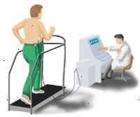 Dibujo que demuestra el electrocardiograma de ejercicio