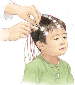 Durante un EEG, se colocan electrodos en el cuero cabelludo de su hijo por lo que la actividad eléctrica del cerebro se puede grabar.