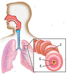 Contorno de una cabeza y pecho humanos con la cabeza girada hacia un lado que muestra el interior de la nariz, la garganta y la tráquea que lleva a los pulmones en el pecho. Primer plano de la proyección de las vías respiratorias se tensó los músculos, forro hinchada, y aumento de la mucosidad.