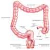 Haga clic para aumentar: de cerca del intestino grueso